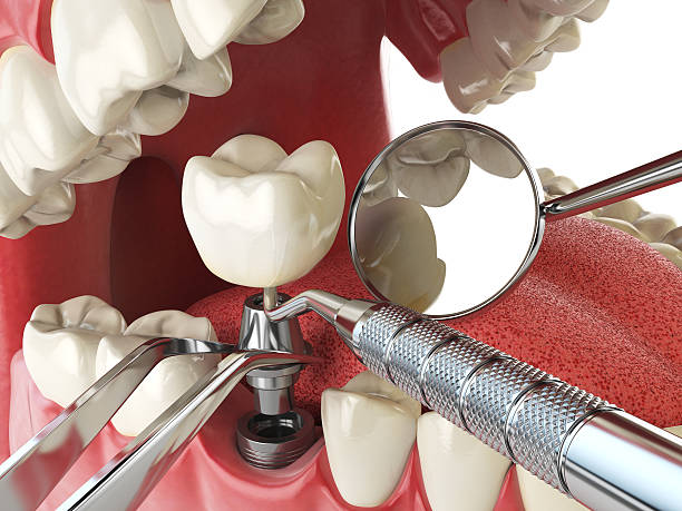 Best Root Canal Emergency Dentist  in Eagle Butte, SD